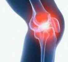 Artritis kolenskega sklepa