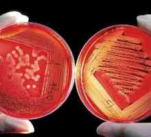 Bakterijski šok v urološki boleznih