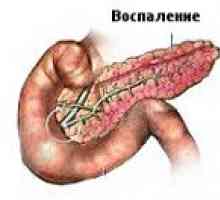Biliarne pankreatitis