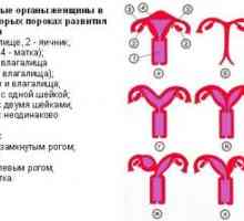 Dve Horned maternice