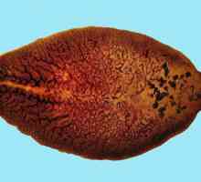 Fascioliasis (Fasciola, jetra krompir, veliki metljaj)