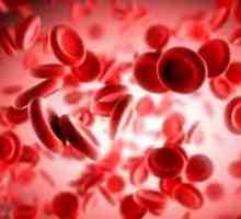 Hemolitična anemija