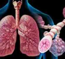 Kronične nespecifični pljučne bolezni