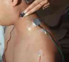 Elektromiografija (EMG)