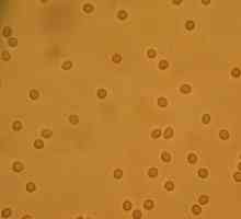 Rdeče krvne celice v urinu