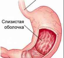 Zdravljenje površinske gastritis