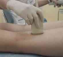 Zdravljenje tromboflebitisa spodnjih udov folk pravna sredstva