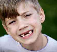 Mlečni zobje pri otrocih in njihovih sprememb