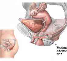 Urinske inkontinence