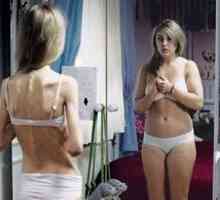 Anoreksije nervoze