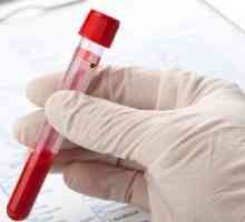 Nizka hemoglobina (anemija)