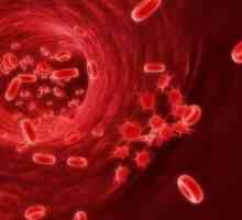 Število trombocitov nizek krvni: vzroki, simptomi, zdravljenje
