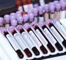 Novo orodje v boju proti hemofilijo