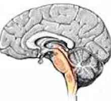 Tumorji možganskega debla
