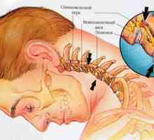 Osteohondroza vratnega dela hrbtenice