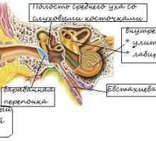 Vnetje srednjega ušesa (vnetje ušesa)