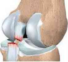 Poškodbe kolenskih vezi