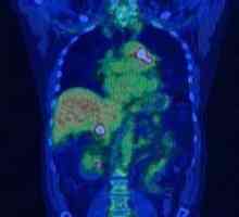 Pozitronsko emisijsko tomografijo (PET)