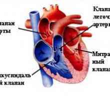 Pridobljene srčne bolezni zaklopk