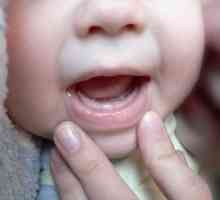 Znaki zob pri dojenčkih