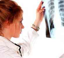 Simptomi pljučnega raka v zgodnji fazi