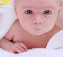 Luščenje kože pri novorojenčkih
