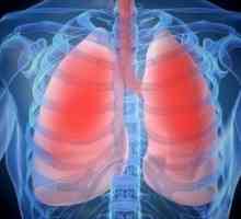 Simptomi bronhitisa pri odraslih
