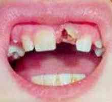 Zobni travma