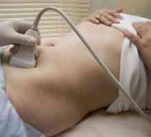 Uzi ledvic in mehurja (ultrazvok)