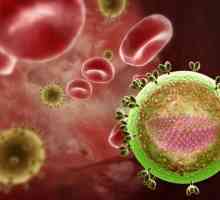 Okužbe s HIV in AIDS-