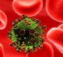 Okužba z virusom HIV