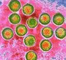 Virus Epstein-Barr (EBV okužbe ali okužbe EBV)