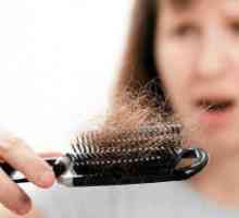 Izpadanje las pri ženskah
