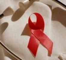 Ženske so še posebej izpostavljeni HIV