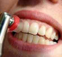 Zobnih oblog (zobni higiena)