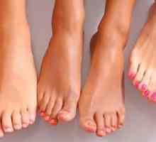 Srbenje in pordelost kože na nogi: prvi alarm