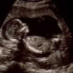 Porodniška pregled med nosečnostjo