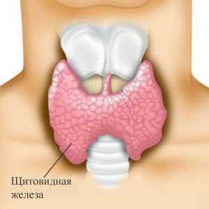 Avtoimunske tiroiditis (Hashimotov tiroiditis)