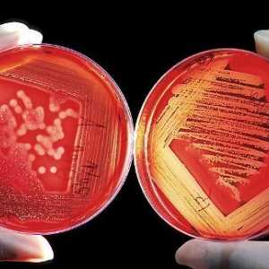 Bakterijski šok v urološki boleznih