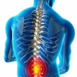 Bolečine v hrbtu: vzroki, zdravljenje