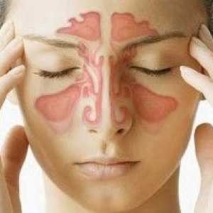 Sinusitis: simptomi, vzroki in zdravljenje