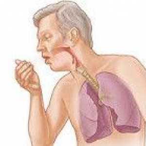 Kronični bronhitis