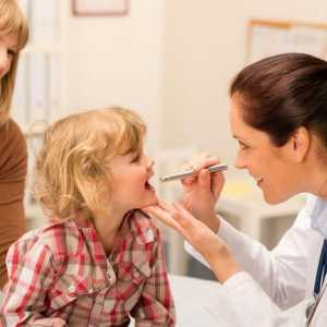 Zdravljenje infekcijske mononukleoze pri otrocih