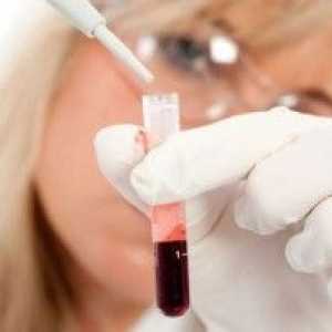 Levkociti v krvi med nosečnostjo