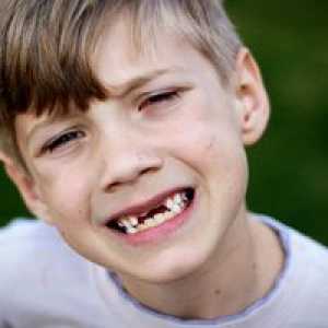 Mlečni zobje pri otrocih in njihovih sprememb