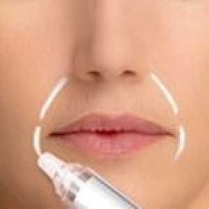 Nosno-ustnične gube