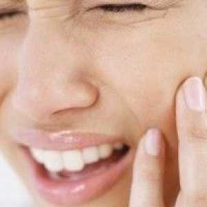 Osteomielitis čeljusti