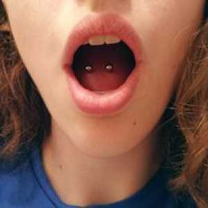 Zungenpiercing povzroča težave z zobmi