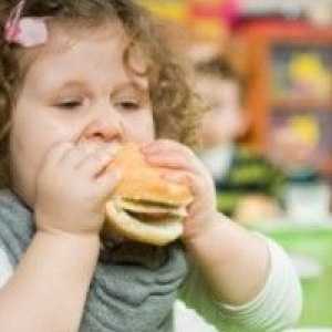 Jesti sproži debelosti pri otrocih