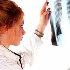 Simptomi pljučnega raka v zgodnji fazi
